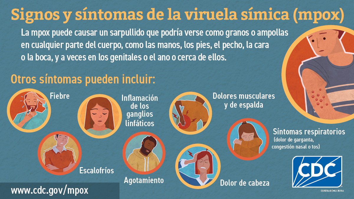 Infographic in Spanish: Signos y síntomas de la viruela símica (monkeypox)
