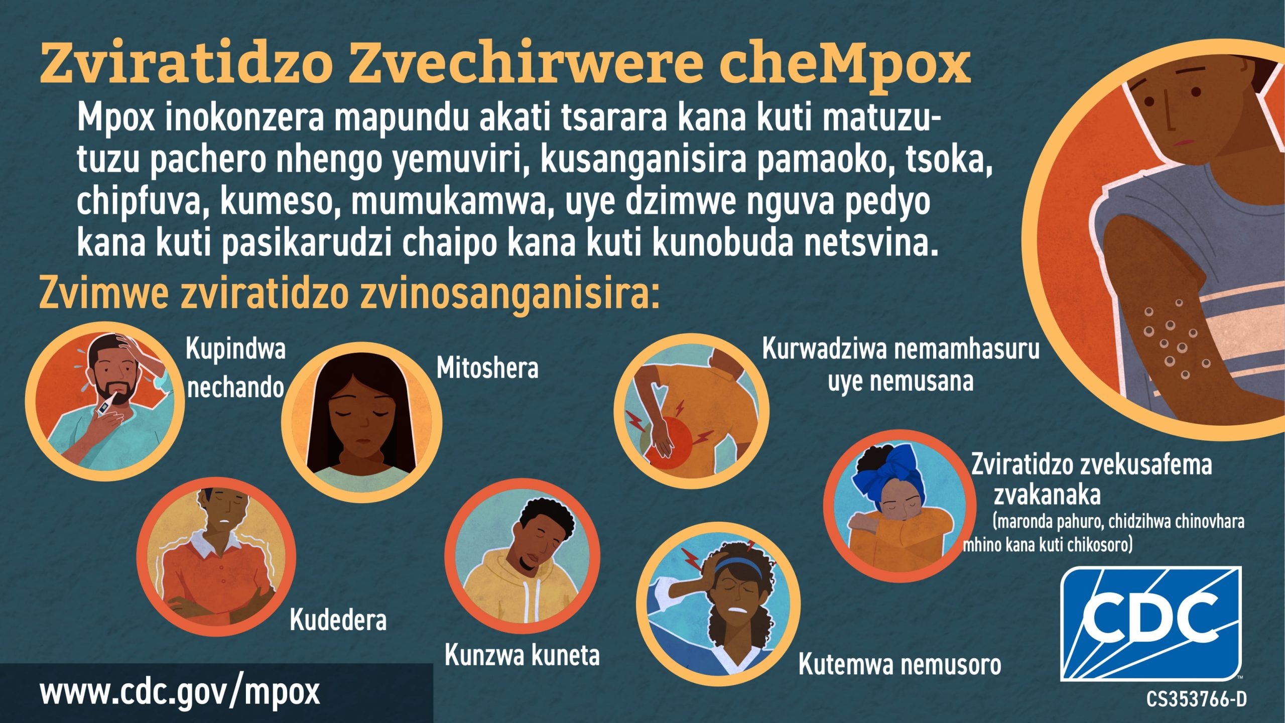 Infographic: Zviratidzo Zvechirwere cheMpox