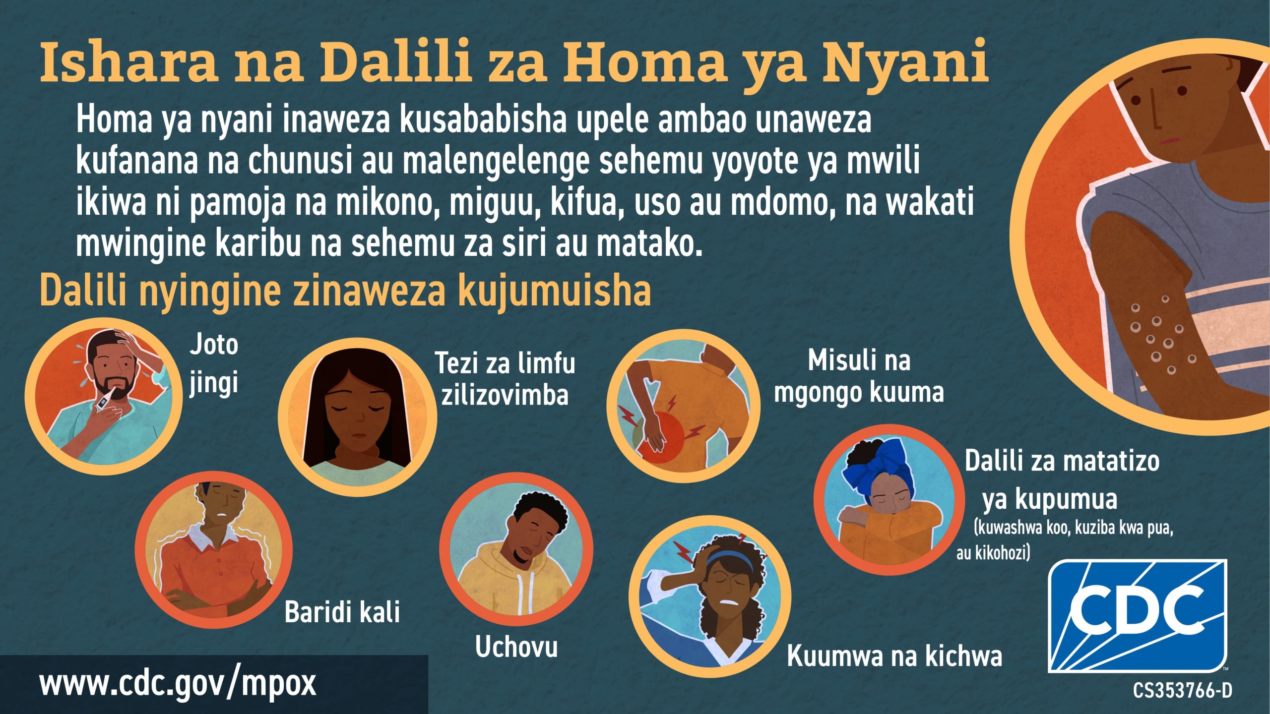 Infographic: Ishara na Dalili za Homa ya Nyani