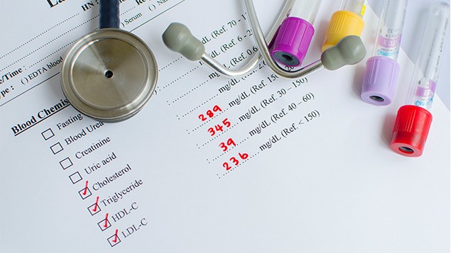 Stethoscope pictured on a cholesterol lab report