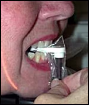 ce589 - Content - Incorrect Head Orientation - Figure 9