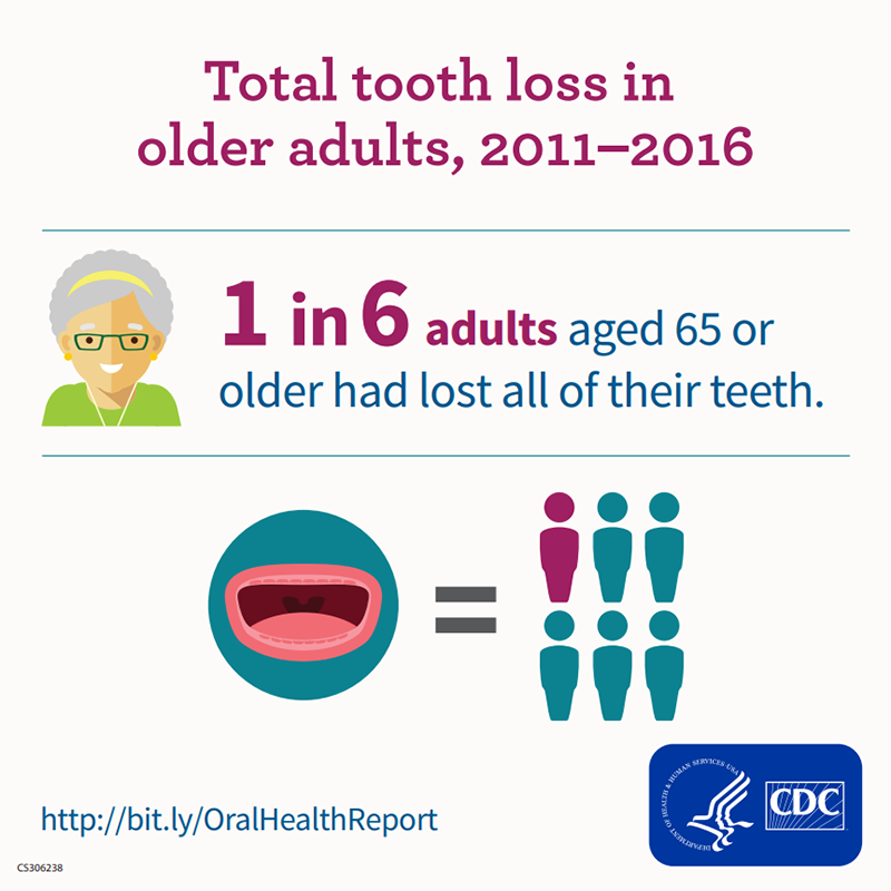 Older Adults and Tooth Loss Older Adults and Tooth Loss